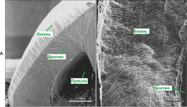 Зображення зуба під скануючим електронним мікроскопом